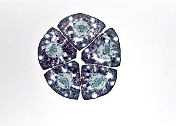 The Promise of Stem Cell Therapy in Regenerative Medicine