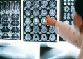 How Advances in Neuroscience Are Transforming Modern Medicine