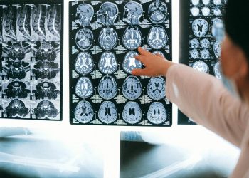 How Advances in Neuroscience Are Transforming Modern Medicine