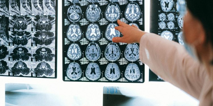 How Advances in Neuroscience Are Transforming Modern Medicine How Advances in Neuroscience Are Transforming Modern Medicine