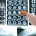 How Advances in Neuroscience Are Transforming Modern Medicine